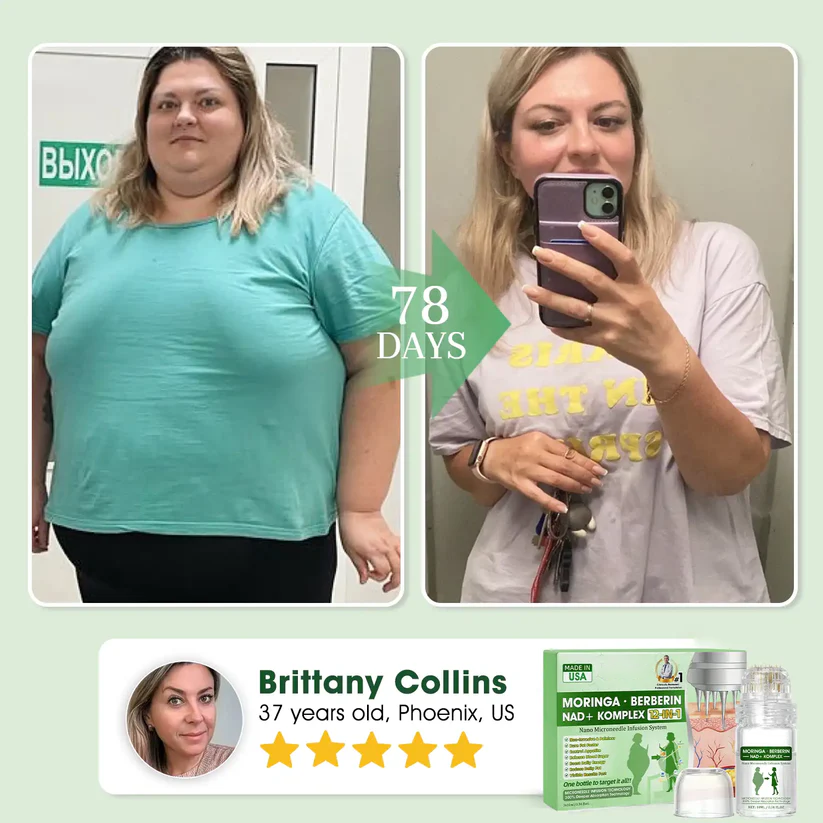 【𝐎𝐟𝐟𝐢𝐜𝐢𝐚𝐥 𝐔𝐒 𝐒𝐭𝐨𝐫𝐞】 ✔️ OUR+® Nano Microneedle Infusion System🔬 – Moringa · Berberine + NAD+ 12-in-1 Metabolic Complex ✨