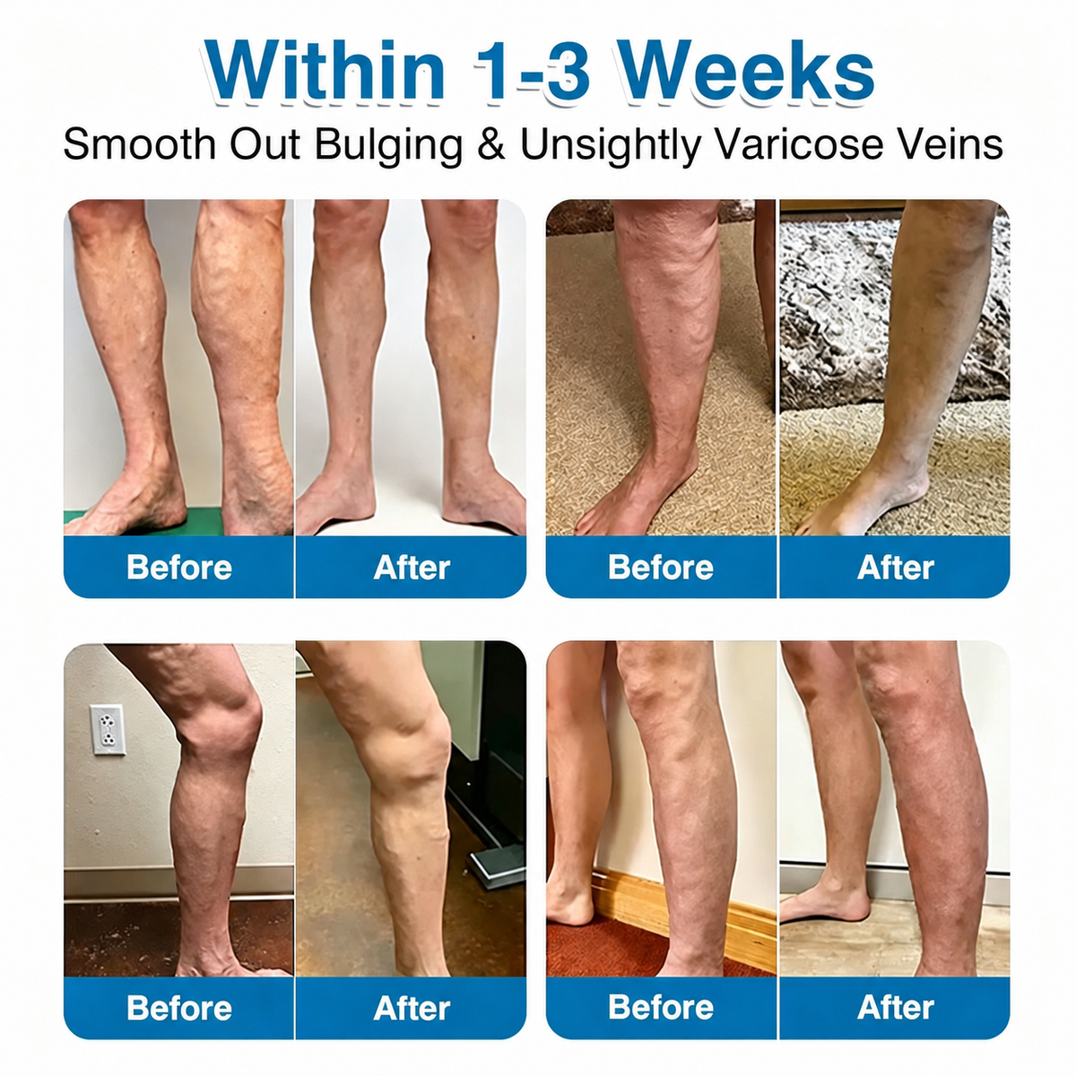 🏅🏃OUR+ Microneedle Patch Roll⚡Instant Relief, Long-Term Results✨