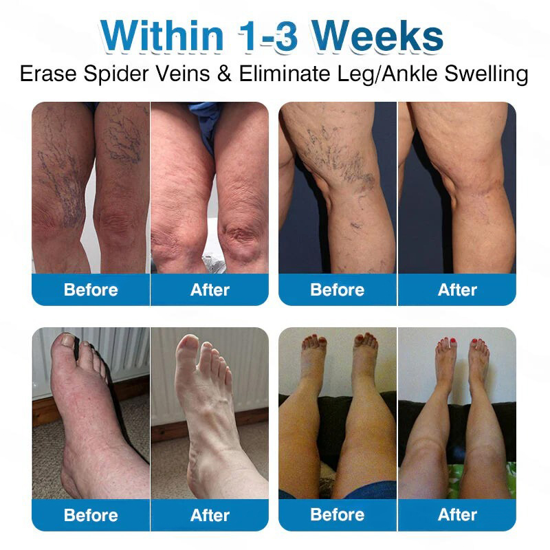 🏅🏃OUR+ Microneedle Patch Roll⚡Instant Relief, Long-Term Results✨