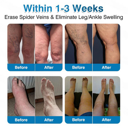 🏅🏃OUR+ Microneedle Patch Roll⚡Instant Relief, Long-Term Results✨