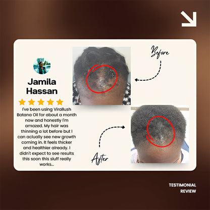 Batana Natural Hair Growth Oil 2.0